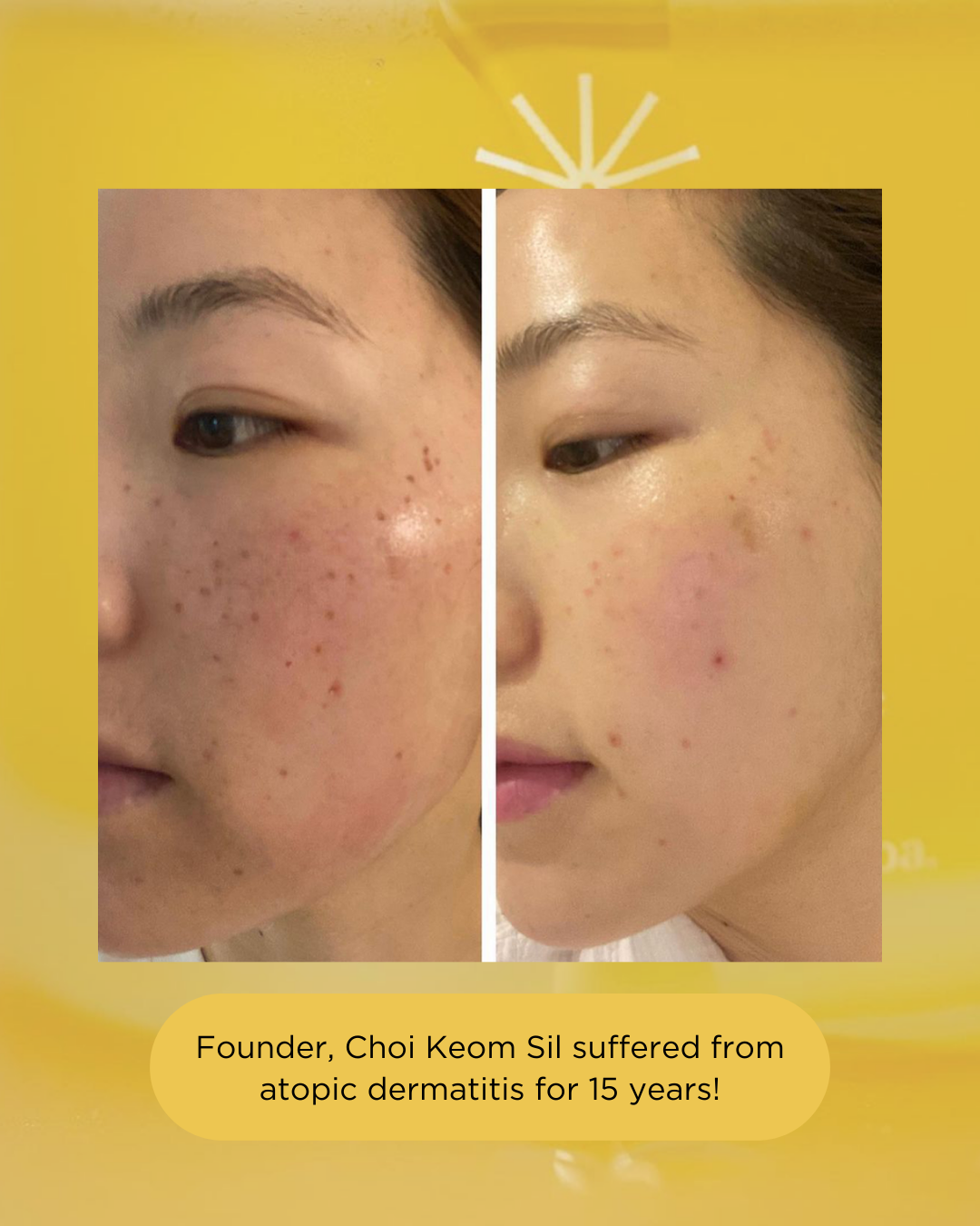 PINKWONDER Jojoba Oil (50ml)