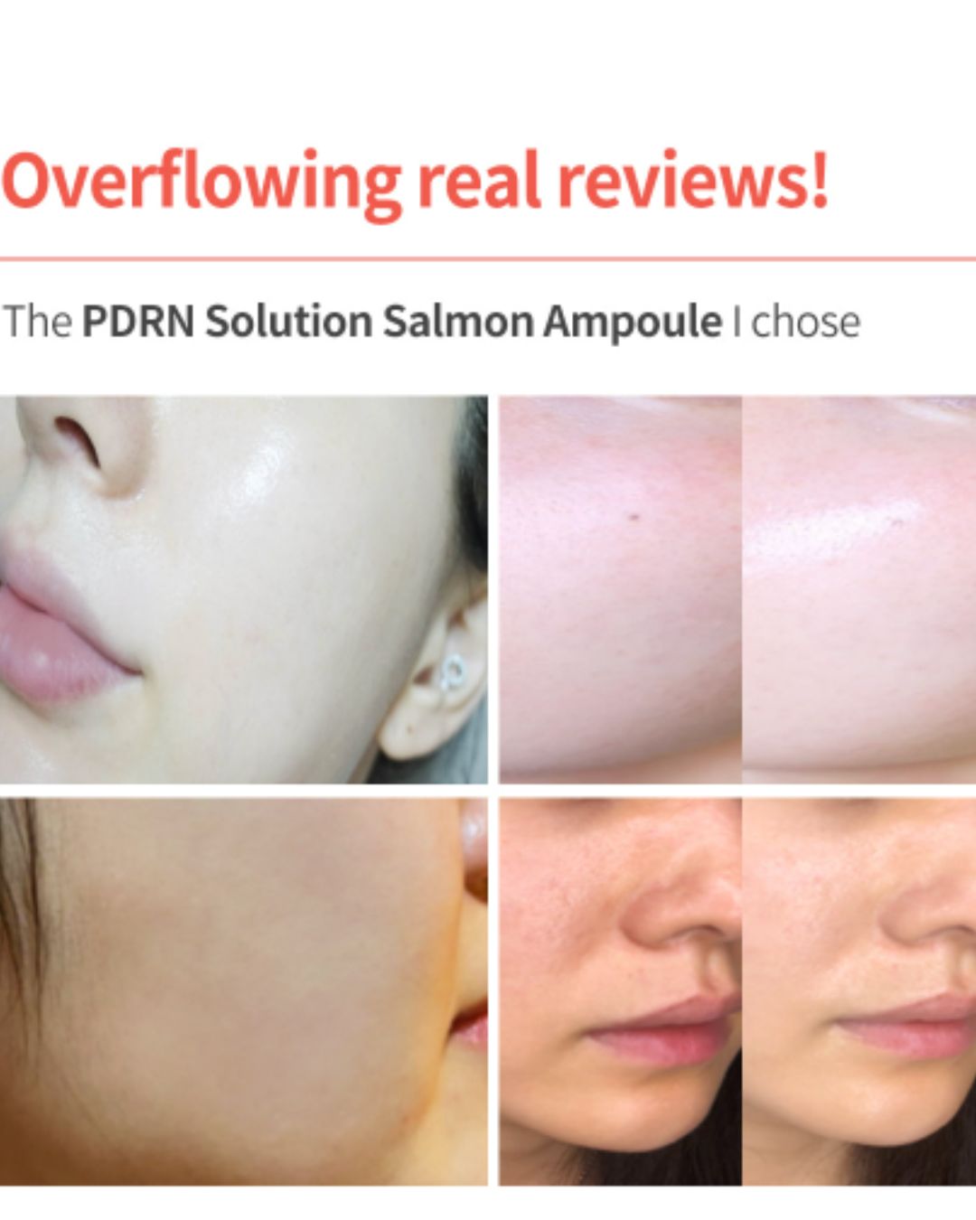 Dermaline PDRN Solution Salmon Ampoule
