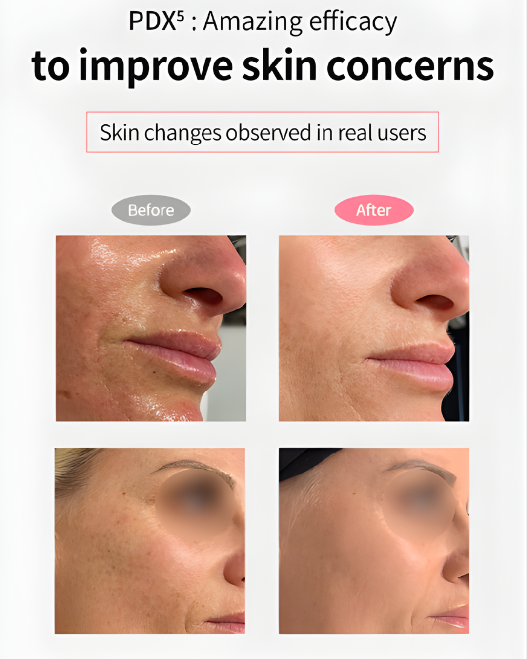 Dermaline PDX5 Skin Booster Total Solution & MTS Stamp