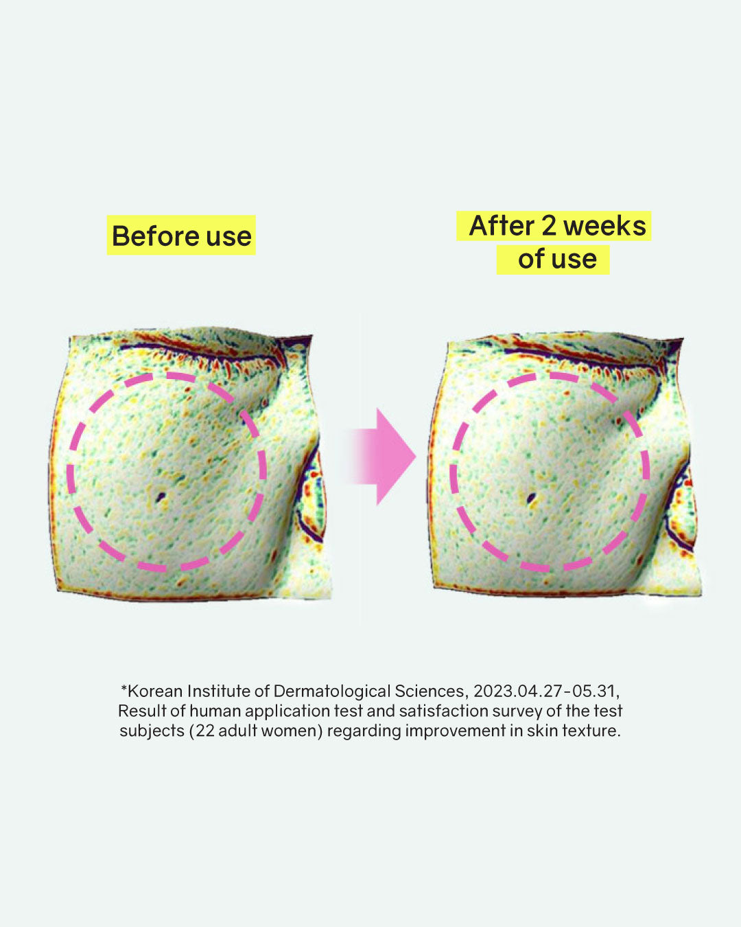 ilso Moringa Tightening Pore Serum