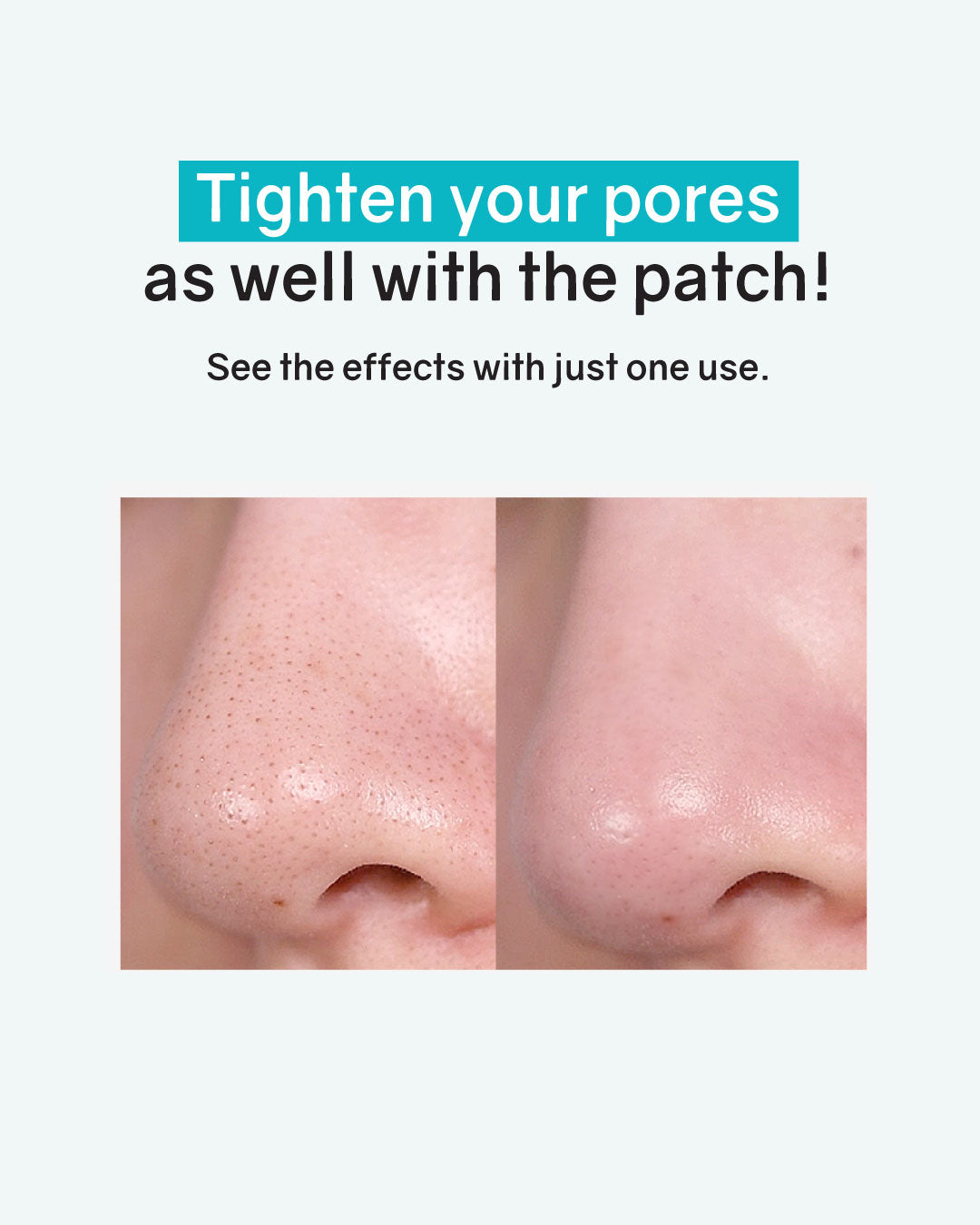 ilso Natural Mild Clear Nose Patch (5ea)