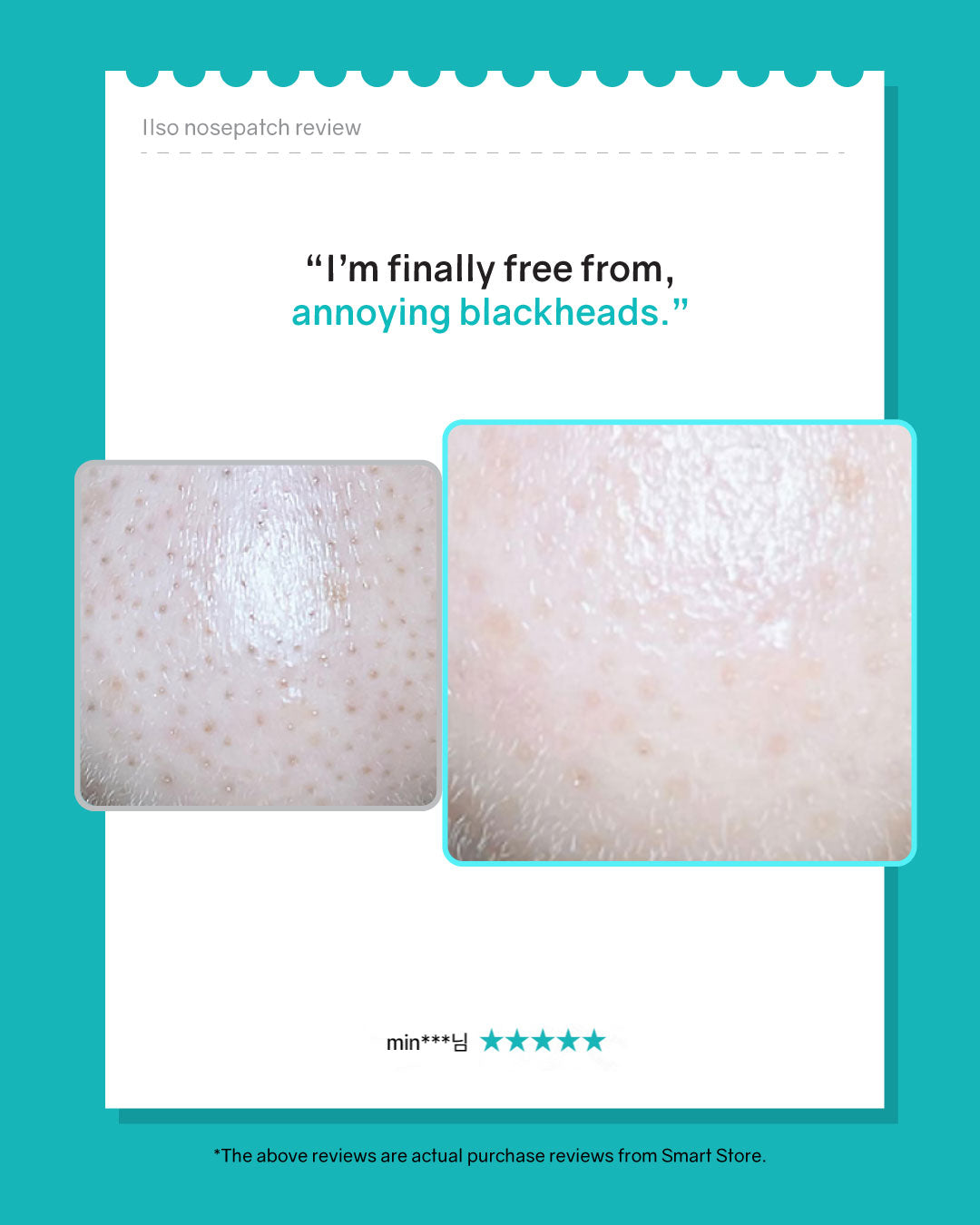 ilso Natural Mild Clear Nose Patch (5ea)