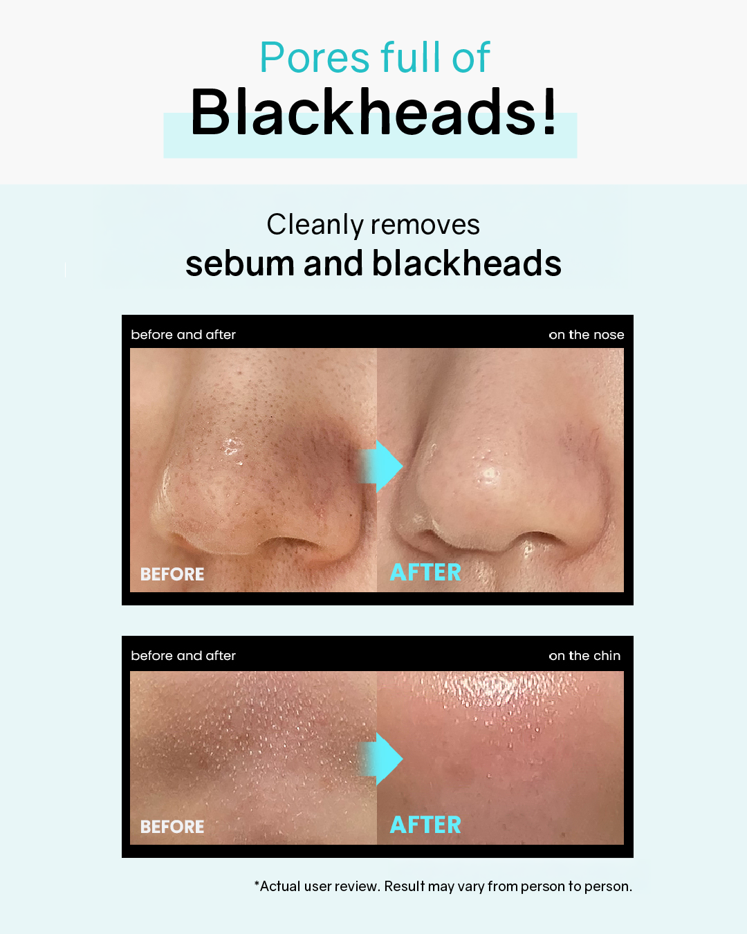 ilso Super Melting Sebum Softener