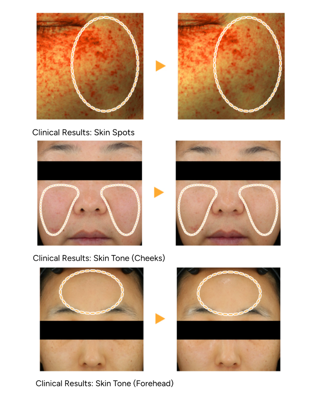 Lavien Vita C Glow Line Brightening Vita Toning Ampoule