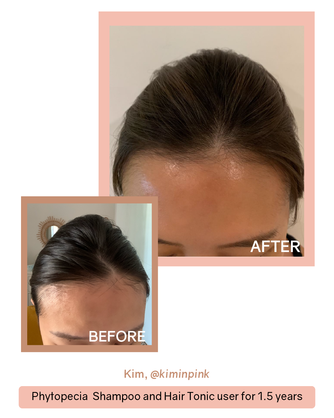 Phytopecia+ Hair Boosting Series