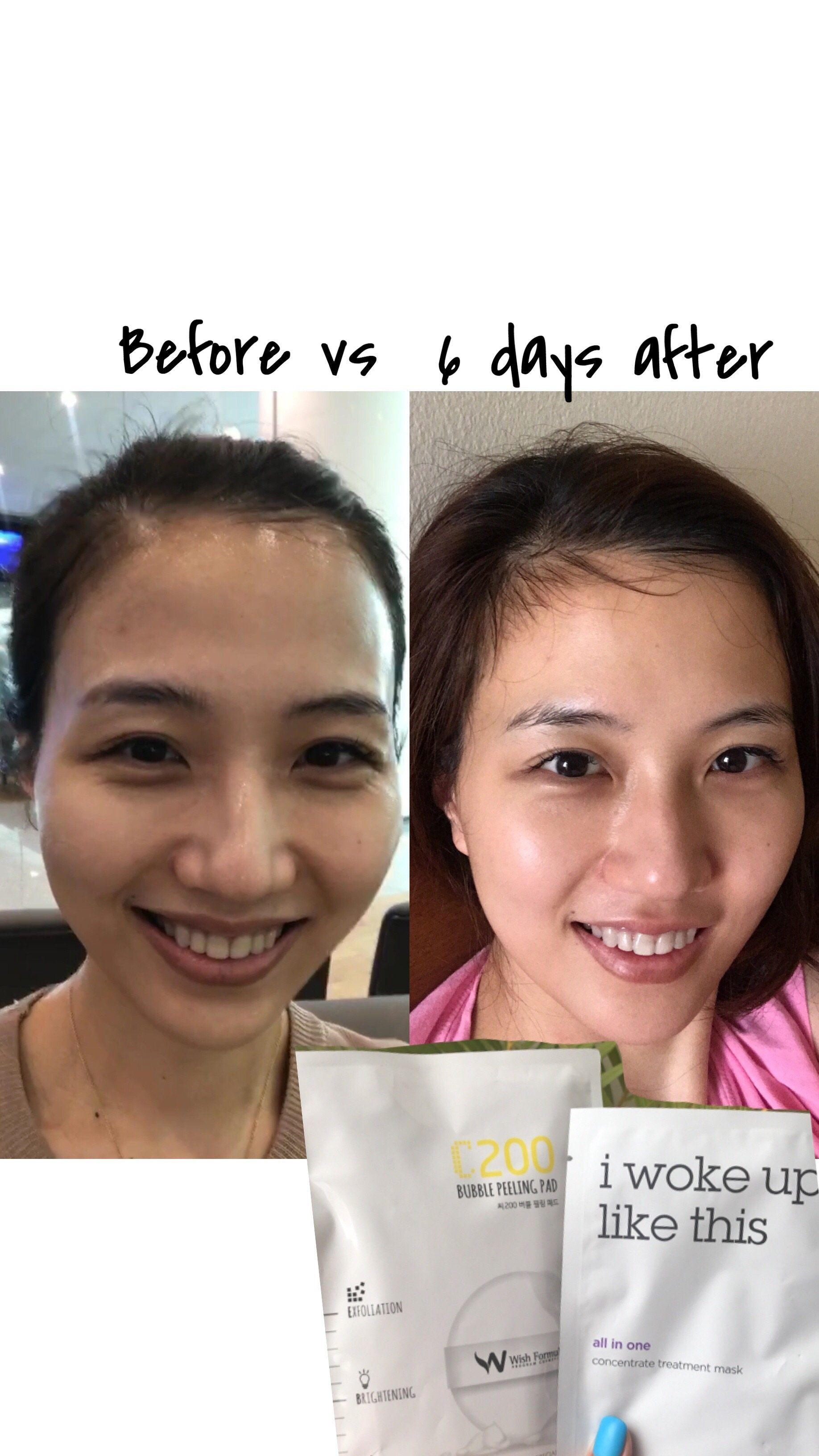 IWLT All in One Concentrate Treatment Mask