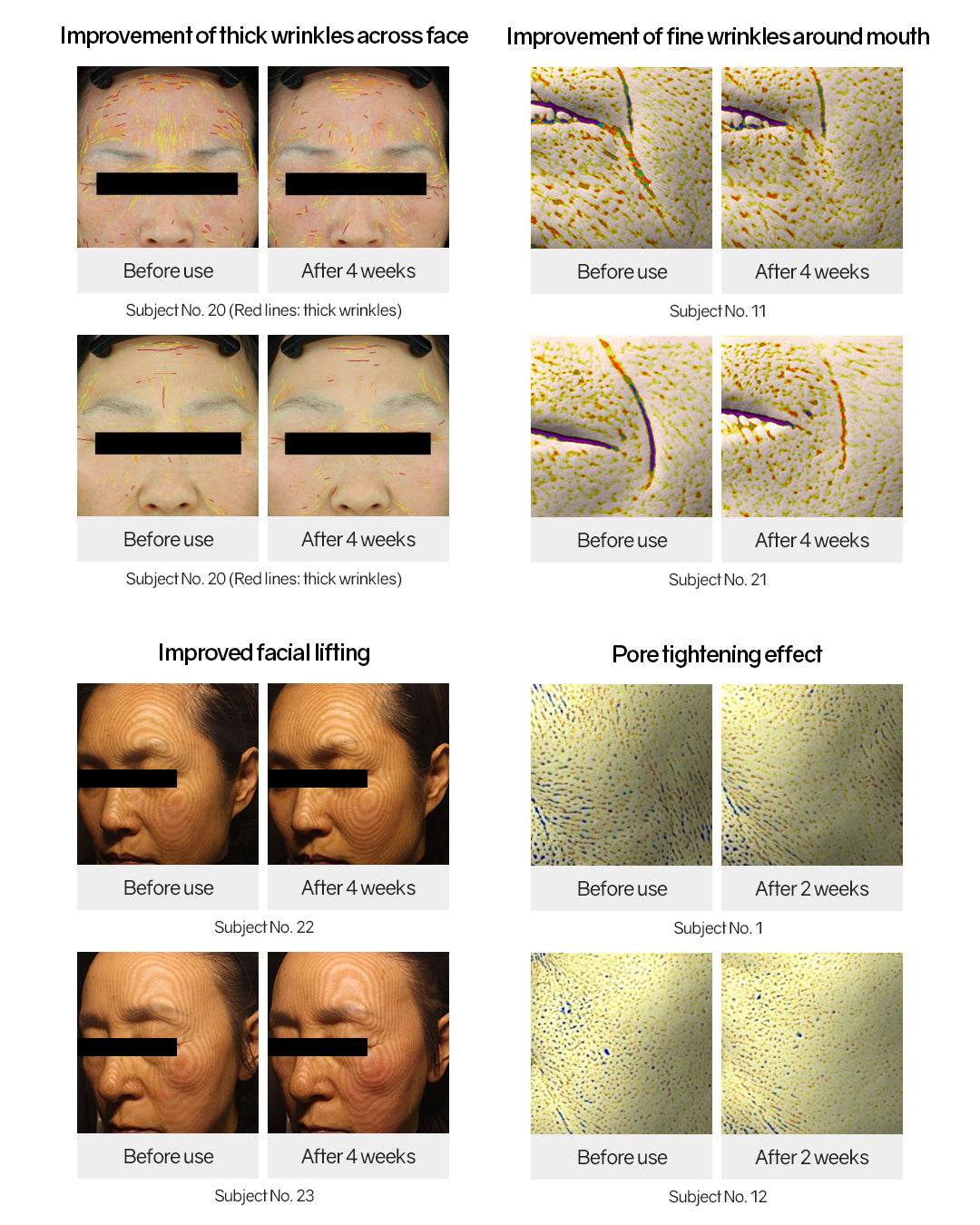 [PROMO] Lavien EGF Micro Pin Ampoule