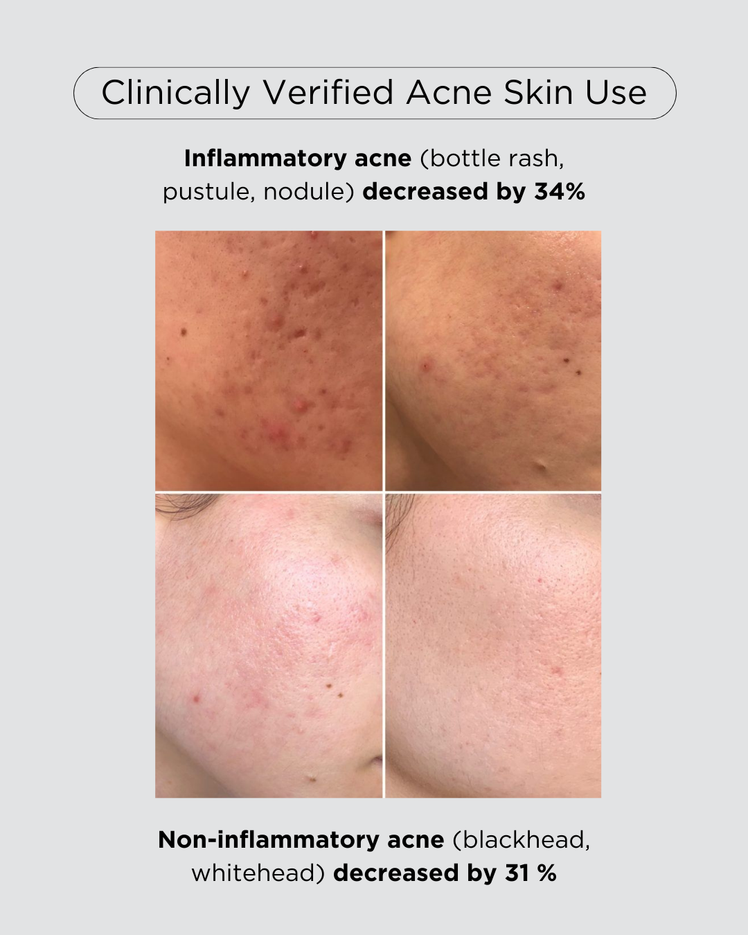 [PROMO] PINKWONDER Tamanu Hero Ampoule