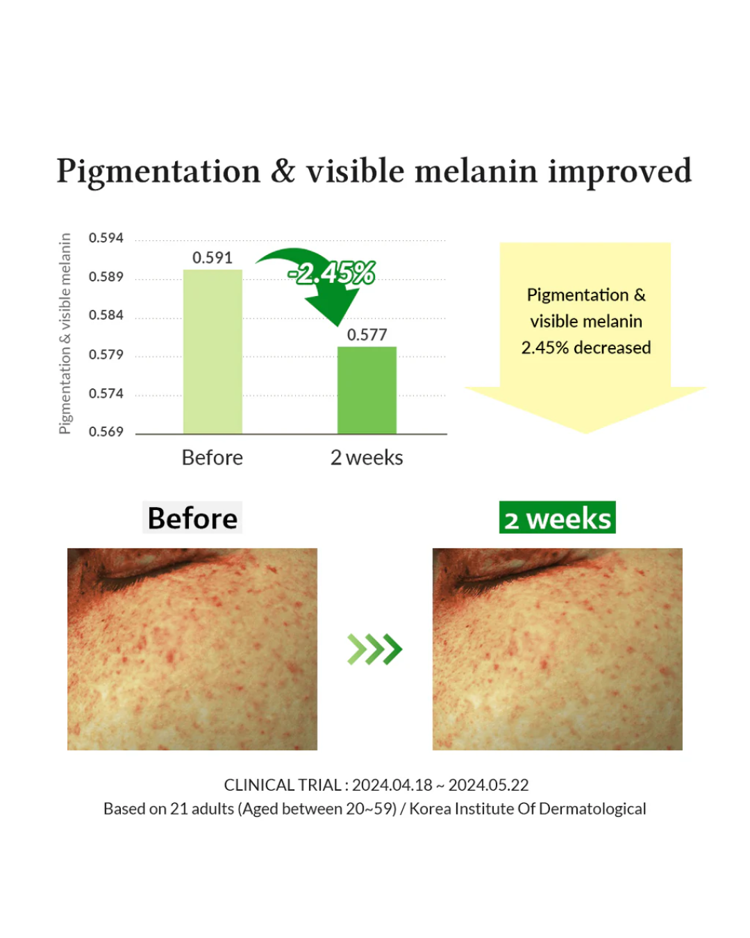 [PROMO] Dr. Althea Gentle Vitamin C Serum (30ml)
