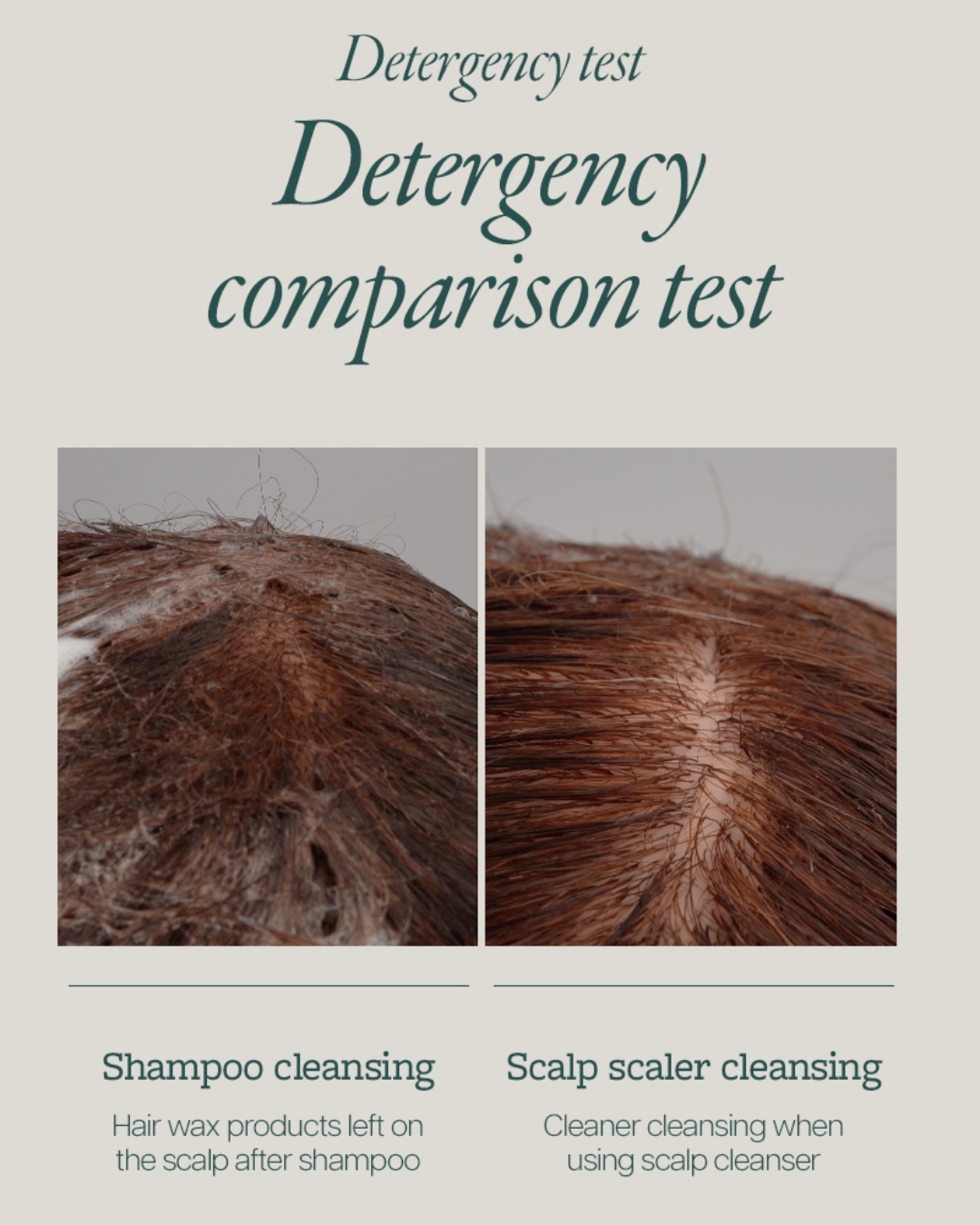 [PROMO] Mintree Sparkling Scalp Scaler