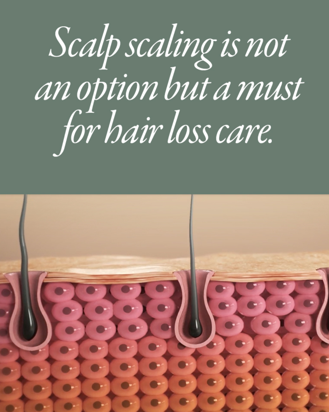 [PROMO] Mintree Sparkling Scalp Scaler