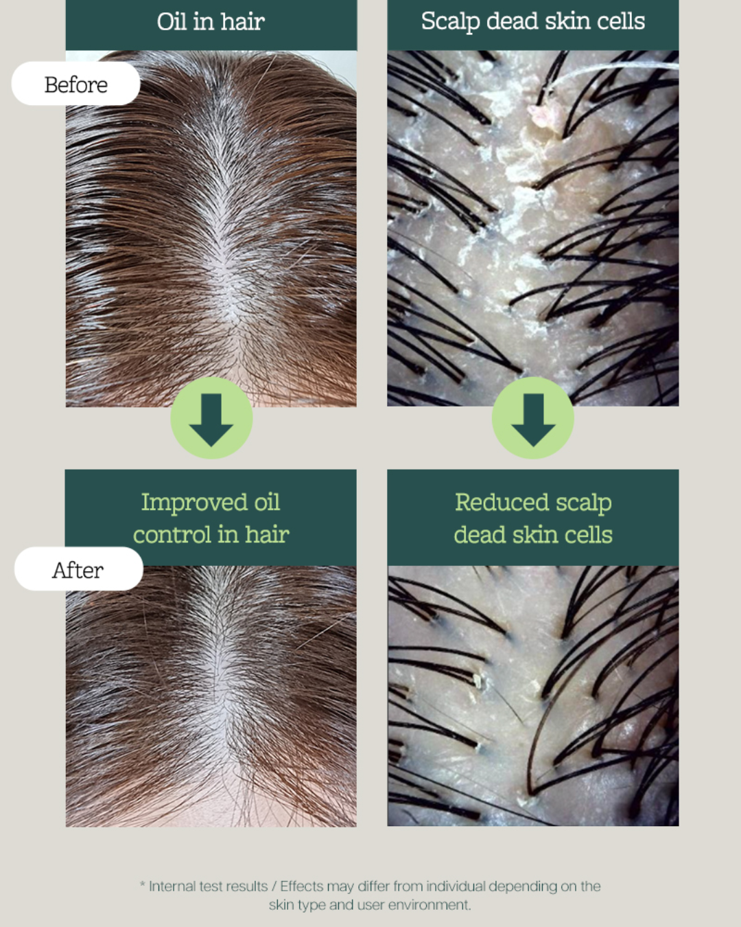 [PROMO] Mintree Sparkling Scalp Scaler