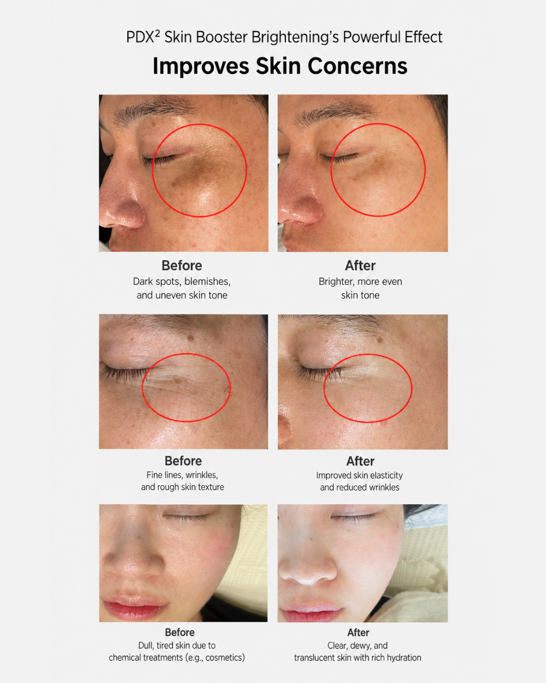 [PROMO] Dermaline Booster Ampoule Bundles (comes with GWP!)
