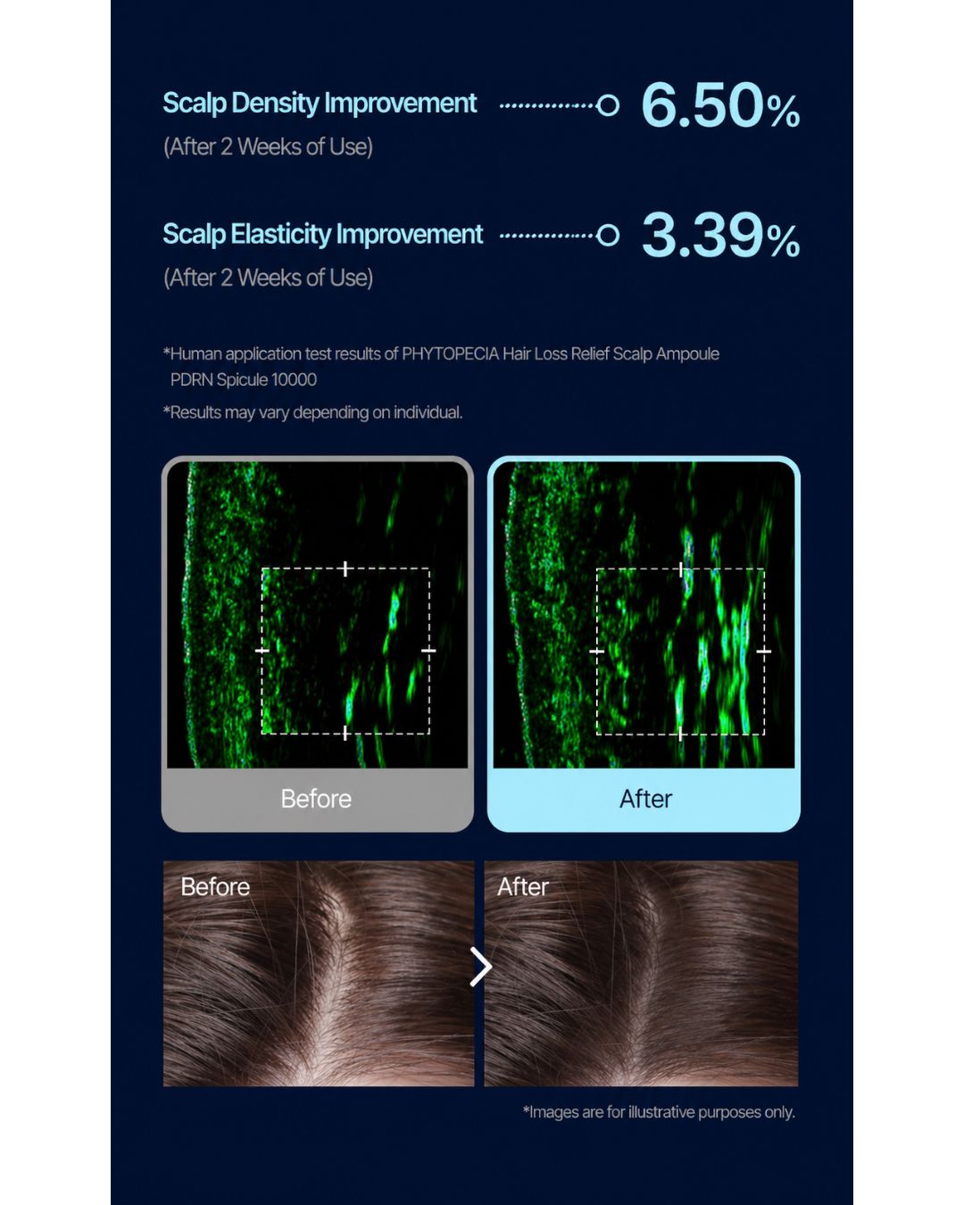 [PROMO] Phytopecia PDRN Spicule 10000 Scalp Ampoule (15ml)