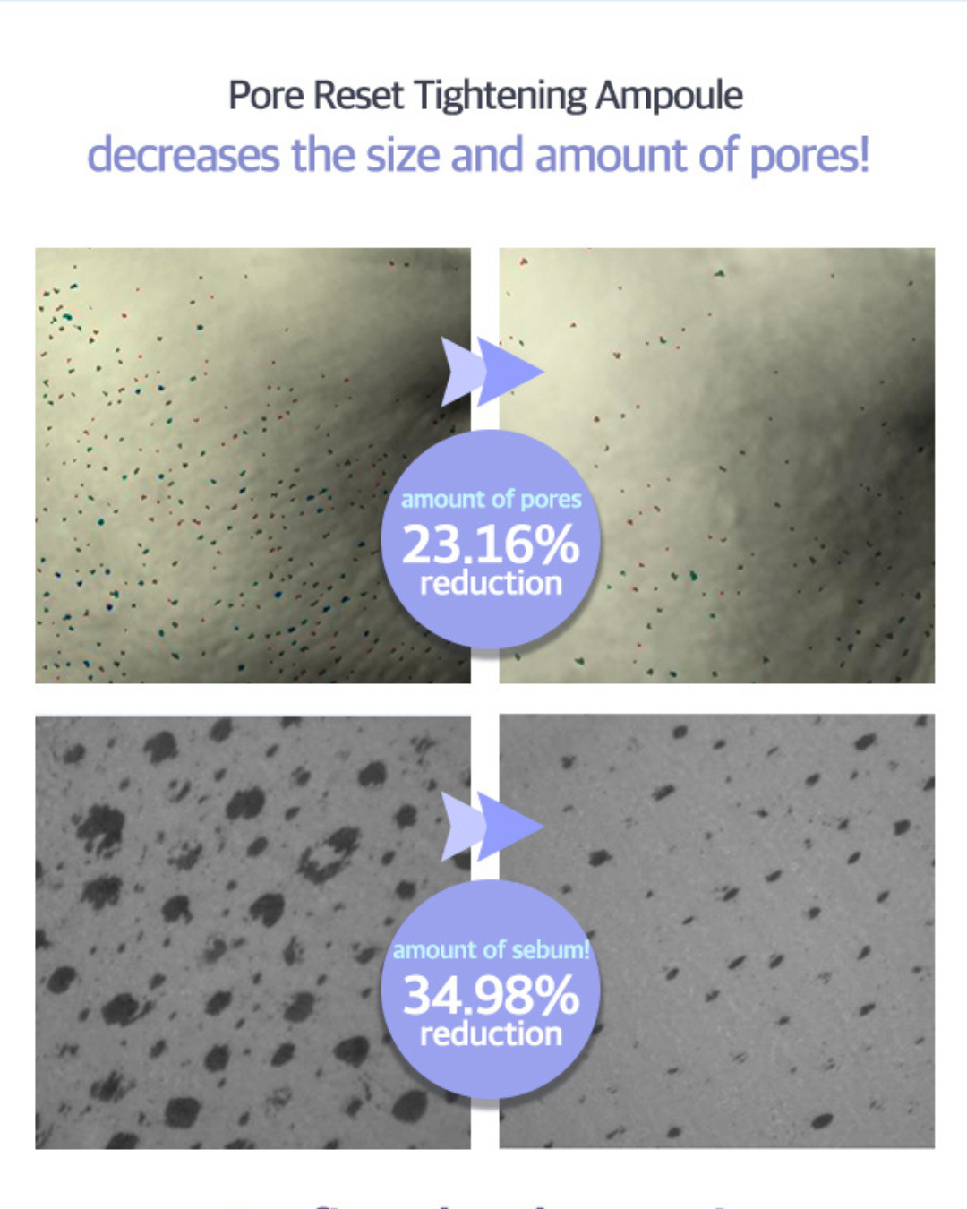 Luvum Pore Reset Tightening Ampoule