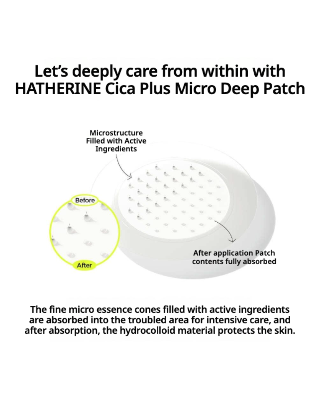 Hatherine Cica + Micro Deep Patch (9 patches) (NEW!)