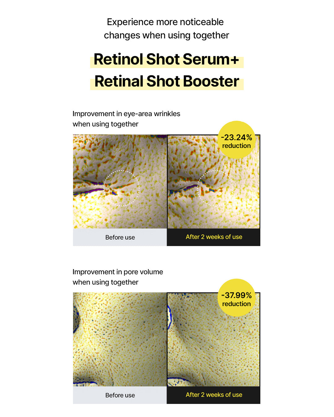 [PREORDER] celimax the Vita-A Retinal Shot Tightening Booster